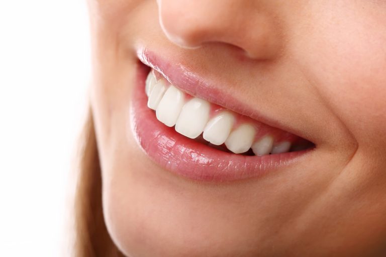 Sonrisa perfecta, cómo pueden ayudarte los tratamientos de estética dental
